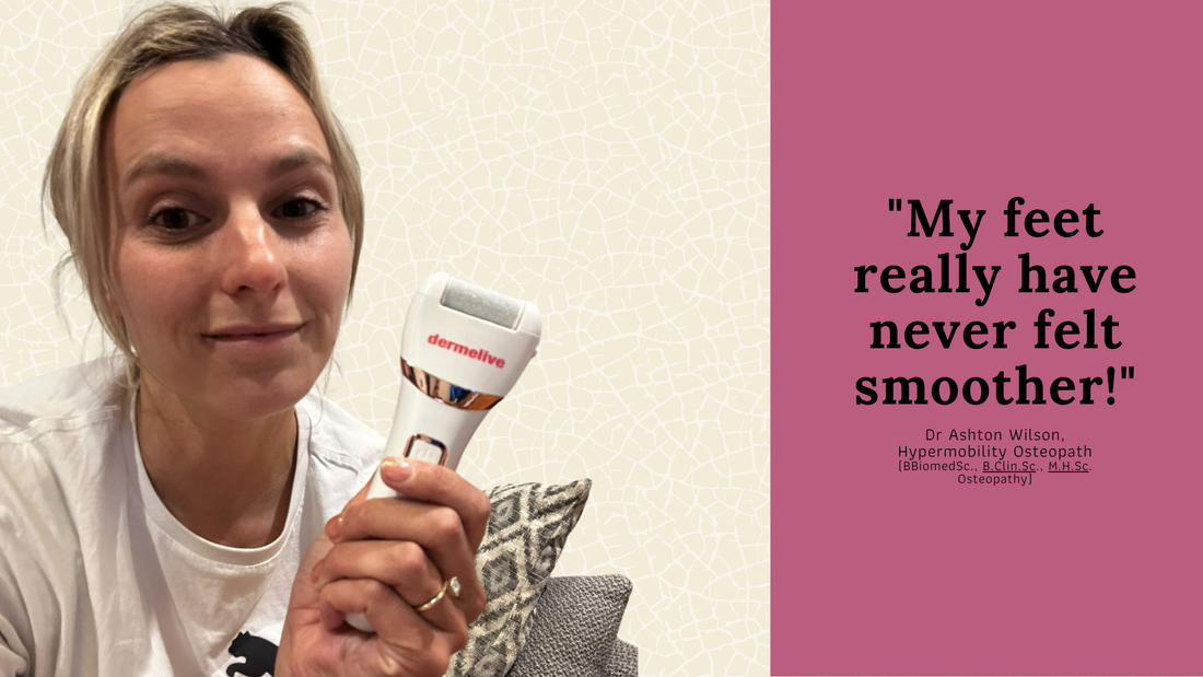 Cracked Heels No More: How Dermelive Helped an Osteopath Stay on Her Feet