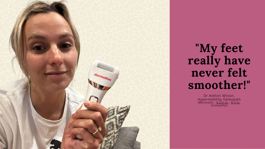 Cracked Heels No More: How Dermelive Helped an Osteopath Stay on Her Feet