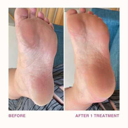 Before and After with One Use of Sole Saver